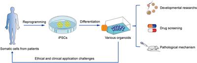 Merits and challenges of iPSC-derived organoids for clinical applications